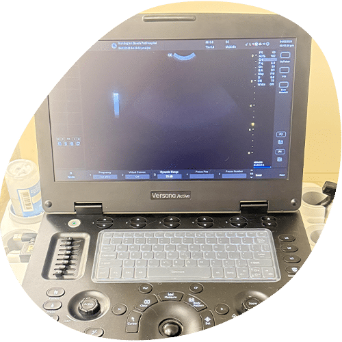 Versana Active ultrasound machine with screen and keyboard